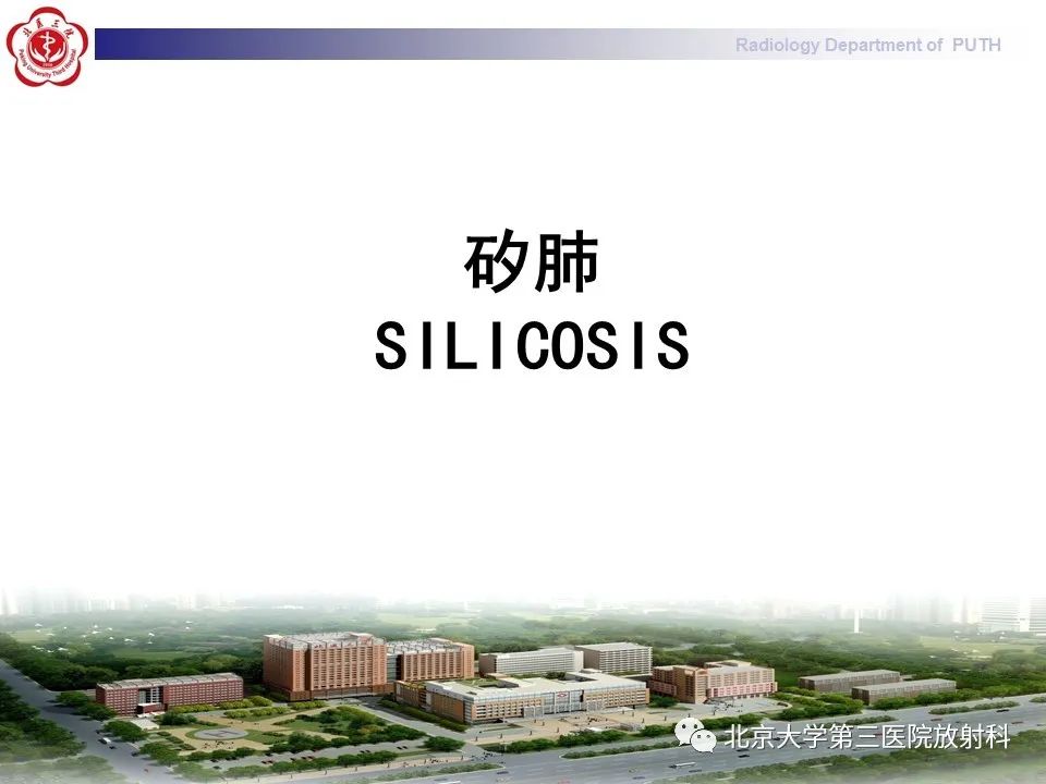 影像PPT - 【PPT】矽肺-10