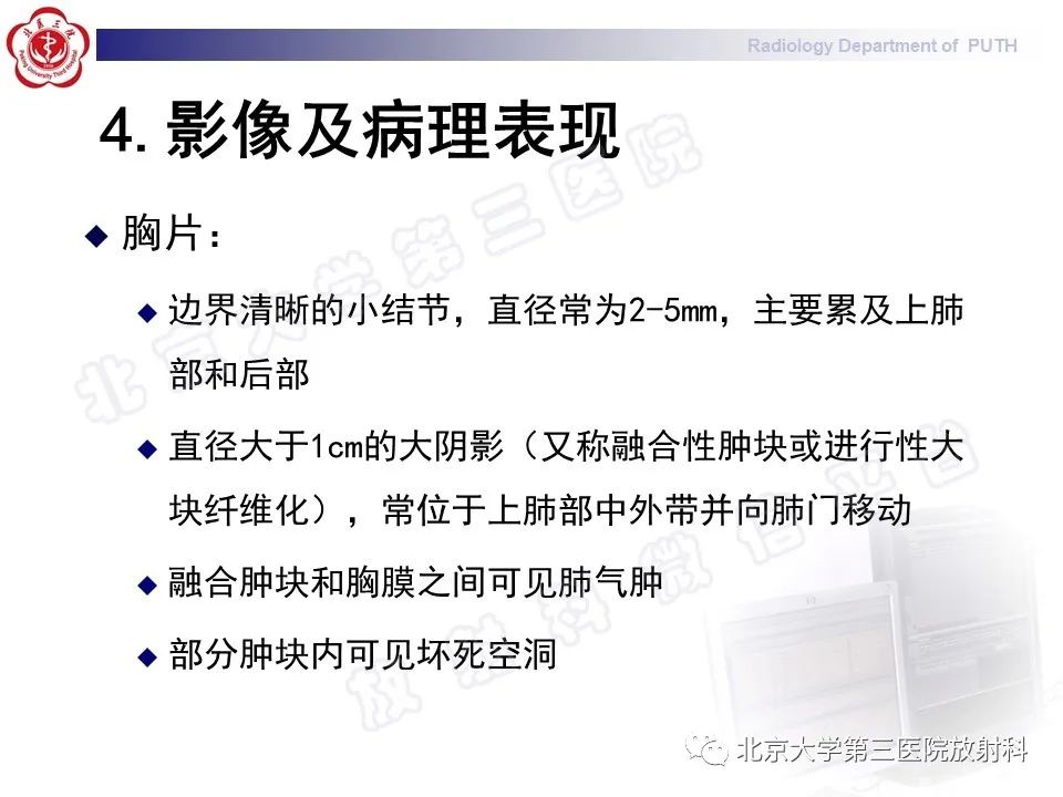 影像PPT - 【PPT】矽肺-16