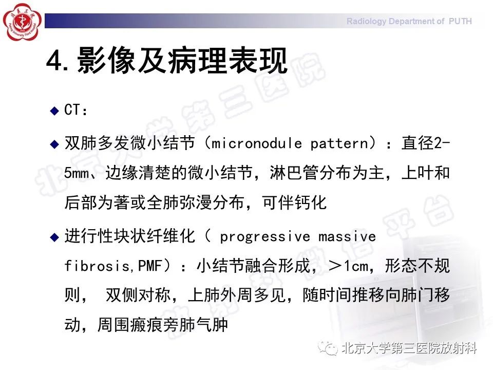 影像PPT - 【PPT】矽肺-17