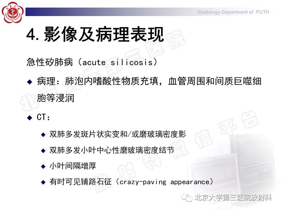 影像PPT - 【PPT】矽肺-26