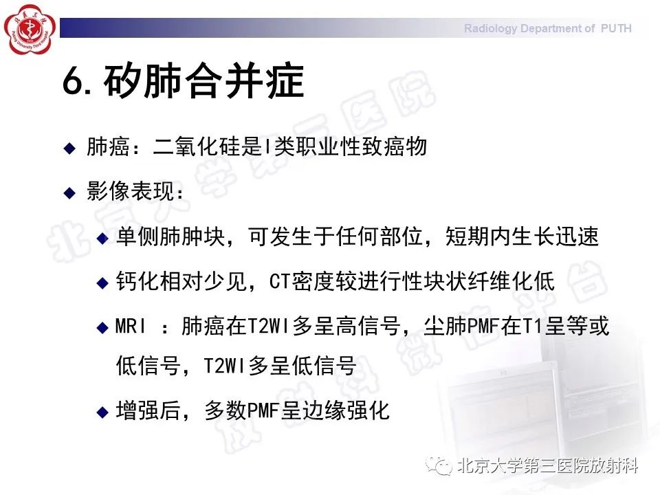 影像PPT - 【PPT】矽肺-30