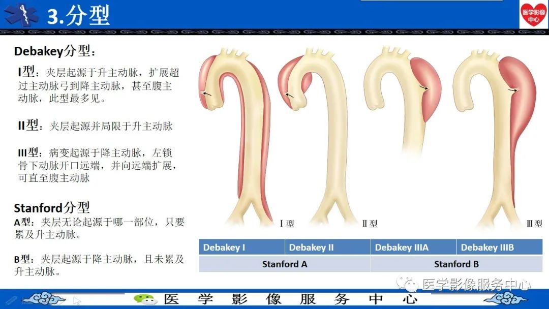 影像PPT - 【PPT】CTA诊断主动脉夹层的内容和征象-21