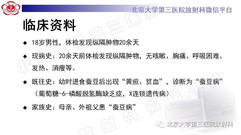 原发性纵隔胚胎性癌-2