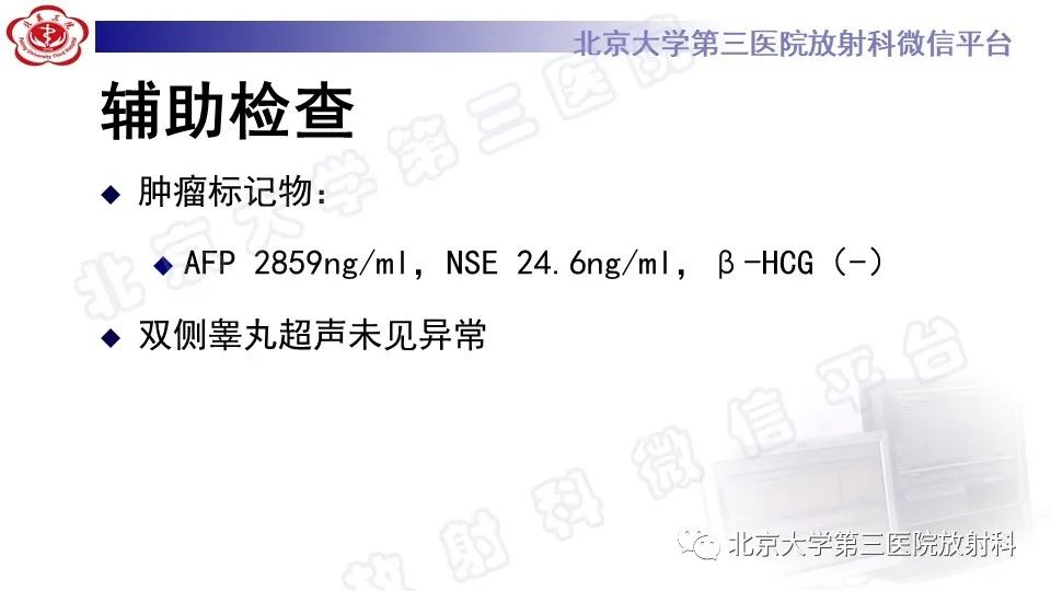 原发性纵隔胚胎性癌-8