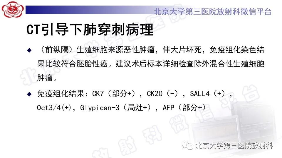 原发性纵隔胚胎性癌-9