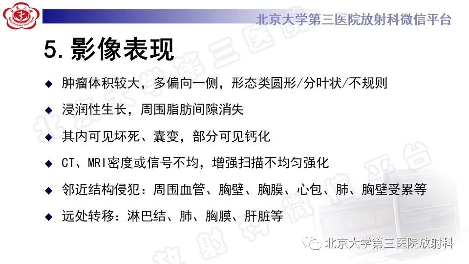 原发性纵隔胚胎性癌-18
