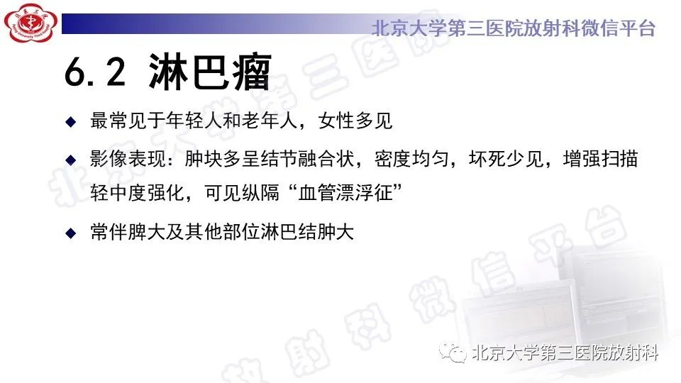 原发性纵隔胚胎性癌-28