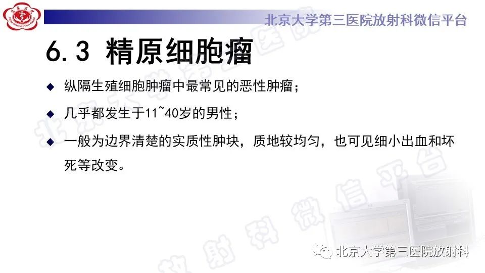 原发性纵隔胚胎性癌-30