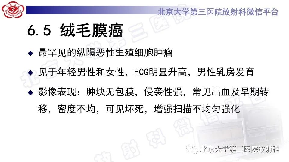 原发性纵隔胚胎性癌-34