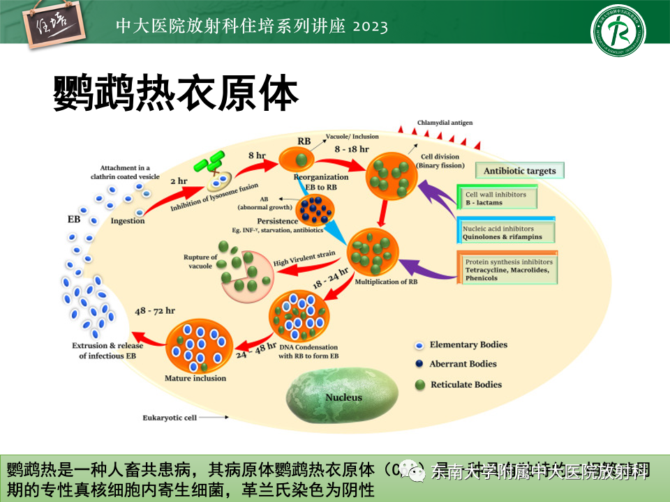肺部特殊感染影像分析-20