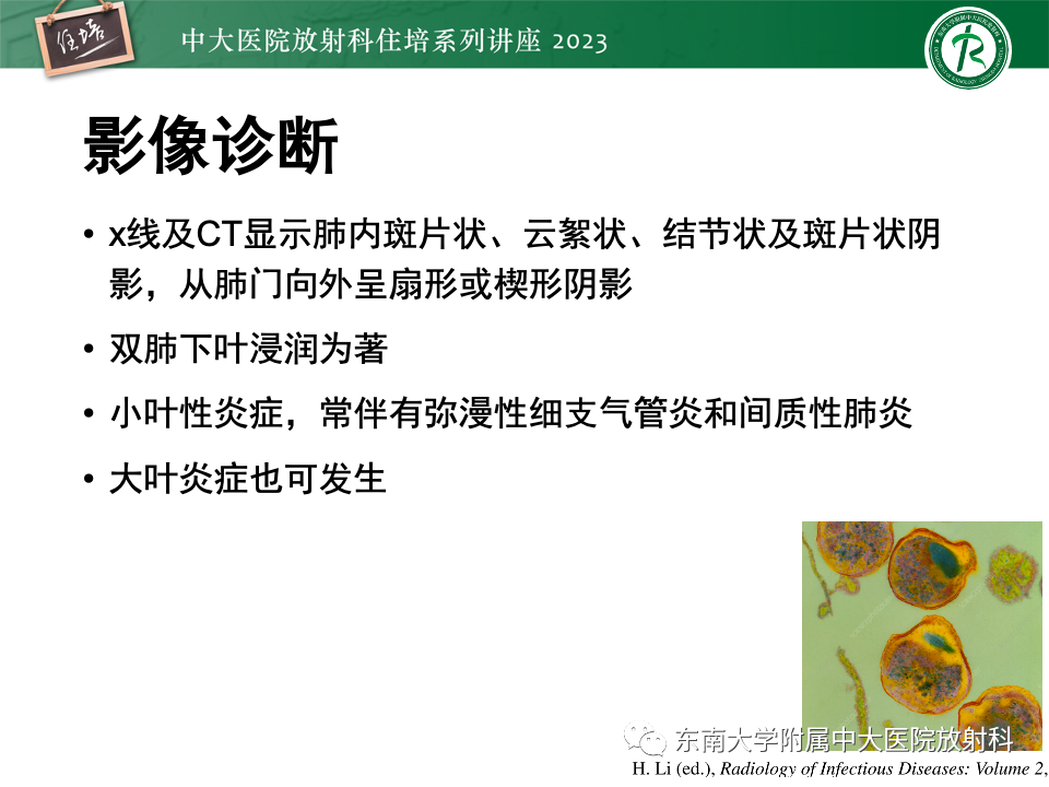 肺部特殊感染影像分析-23