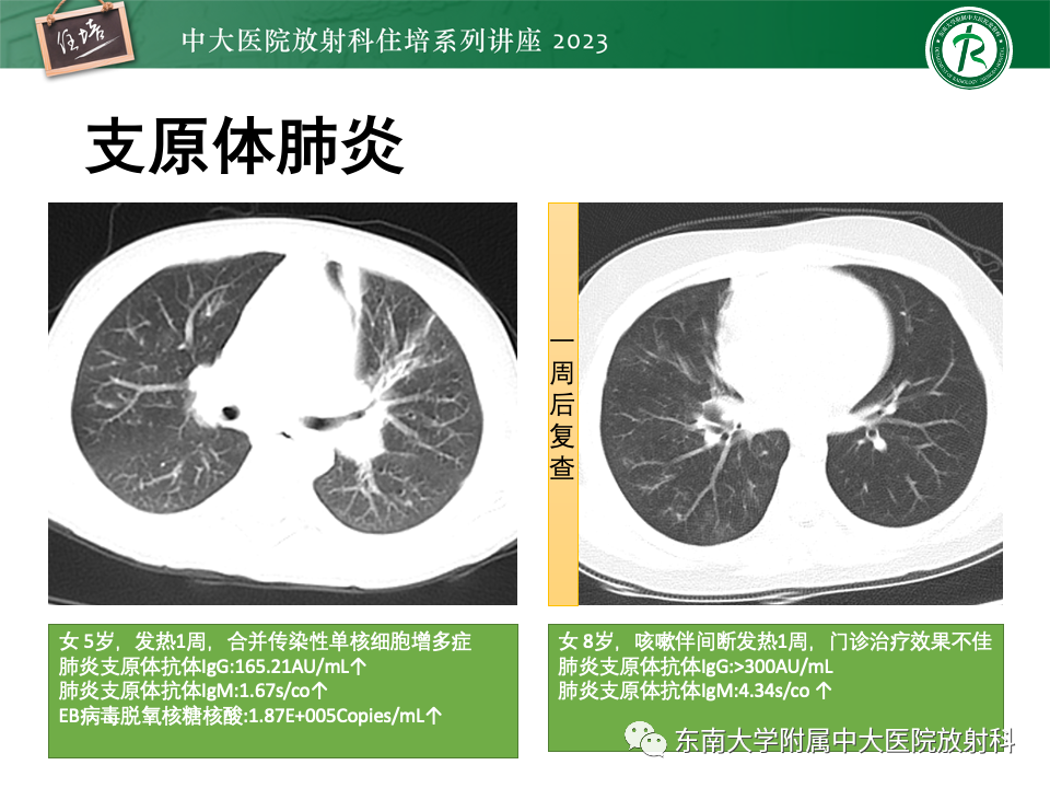肺部特殊感染影像分析-32