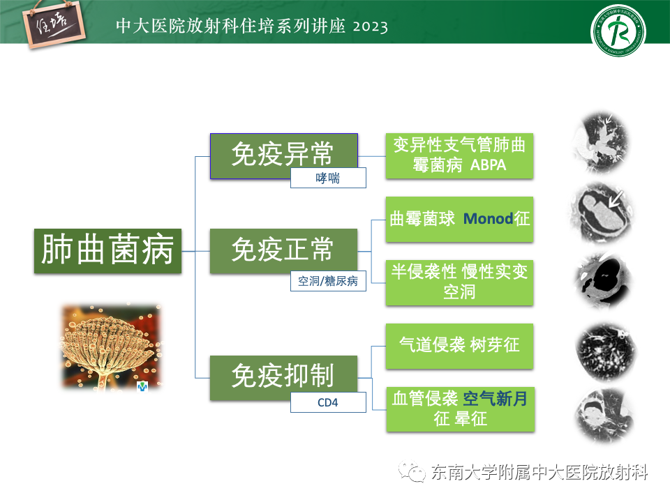 肺部特殊感染影像分析-36