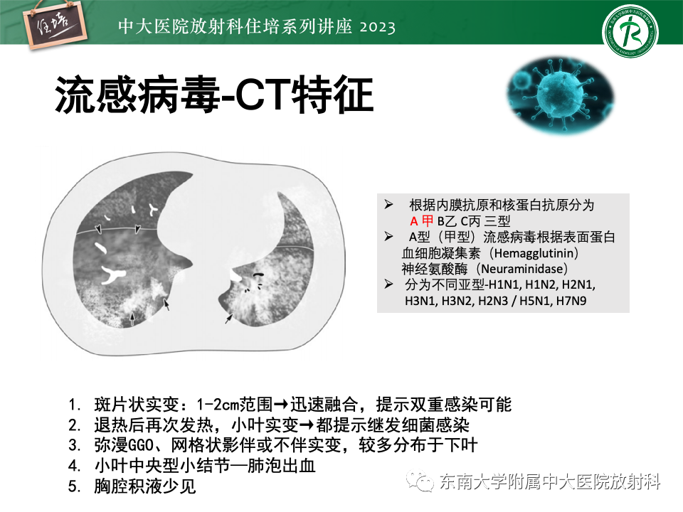 肺部特殊感染影像分析-56