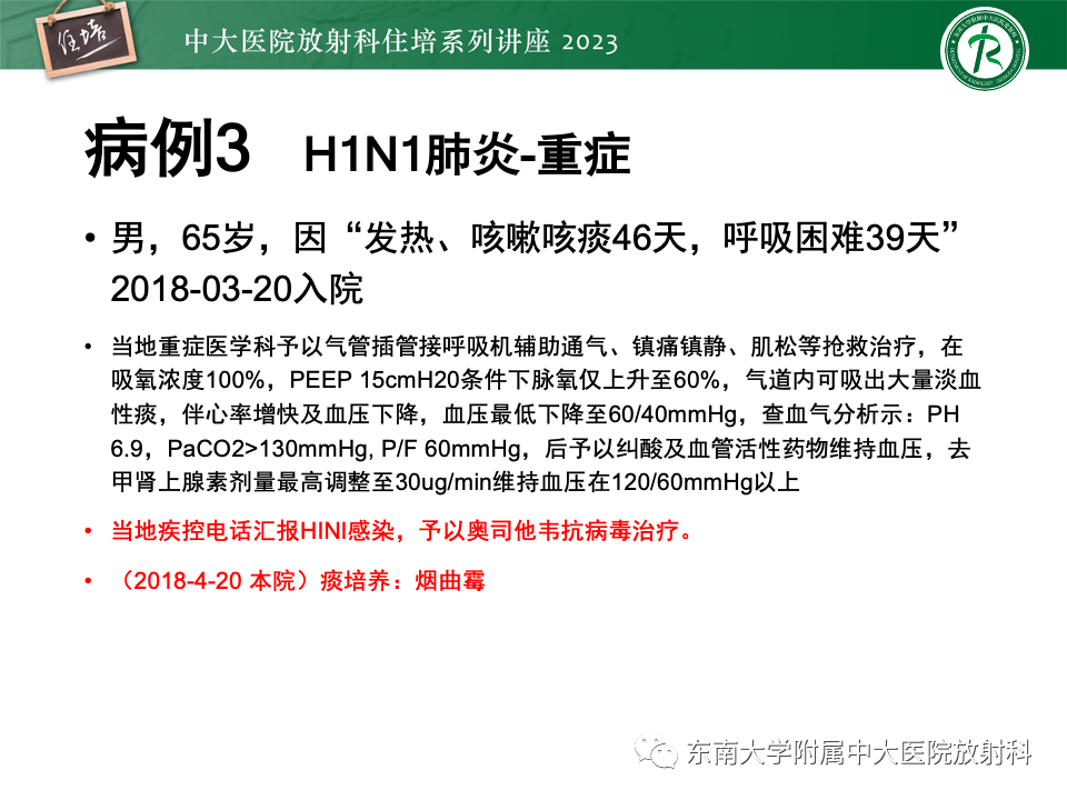 肺部特殊感染影像分析-57