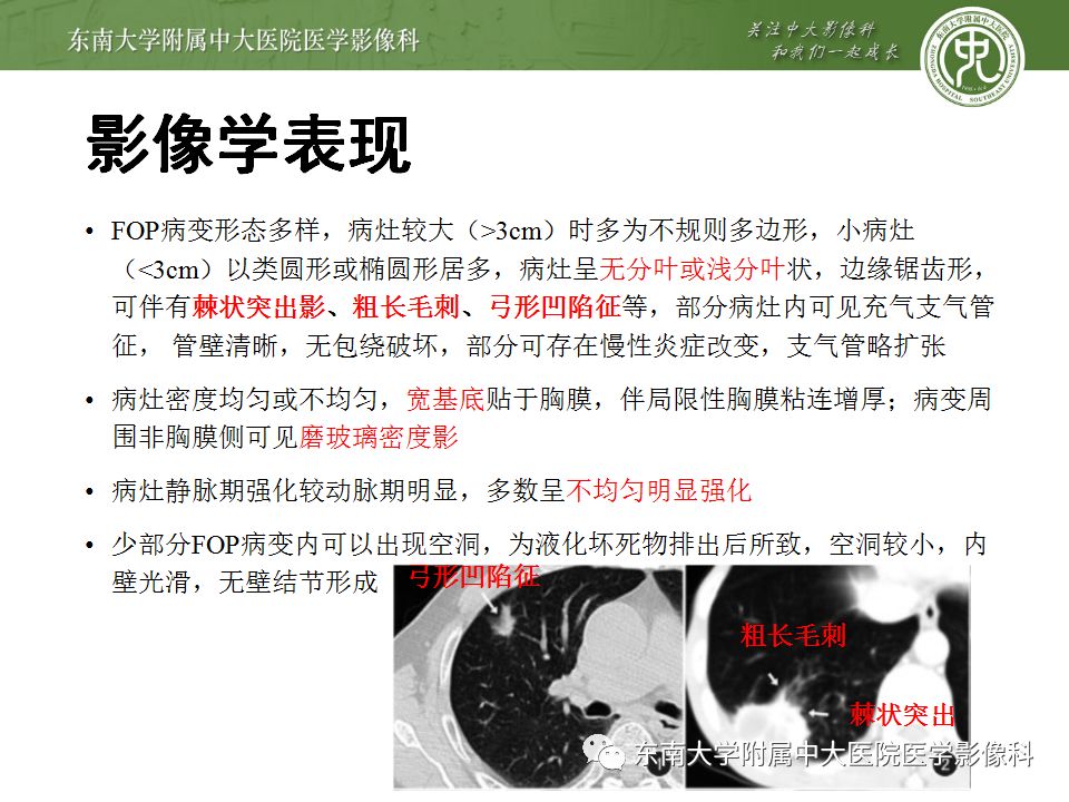 【PPT】局灶性机化性肺炎与周围型肺癌的鉴别-17