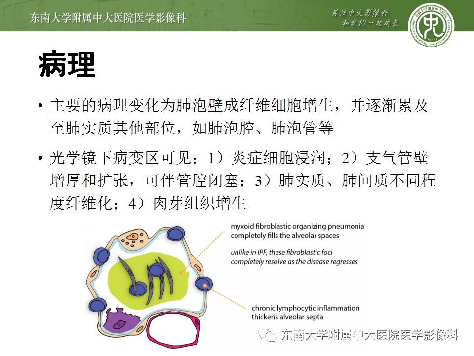 【PPT】局灶性机化性肺炎与周围型肺癌的鉴别-14
