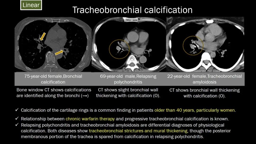 【PPT】肺部CT高密度病变诊断思路-31