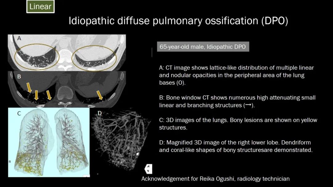 【PPT】肺部CT高密度病变诊断思路-27