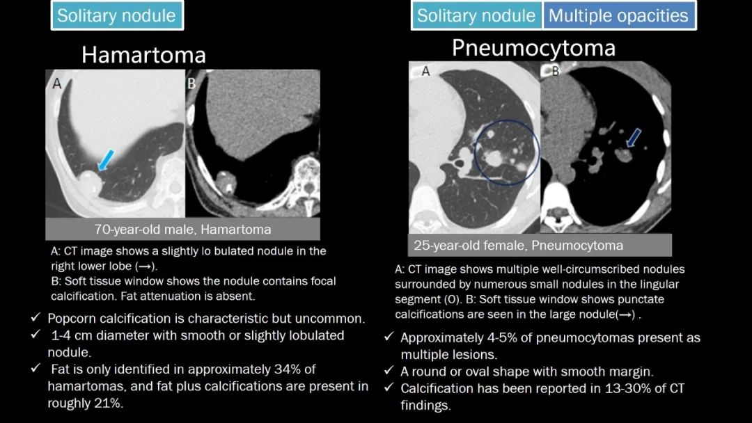 【PPT】肺部CT高密度病变诊断思路-49