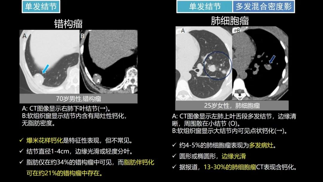 【PPT】肺部CT高密度病变诊断思路-50