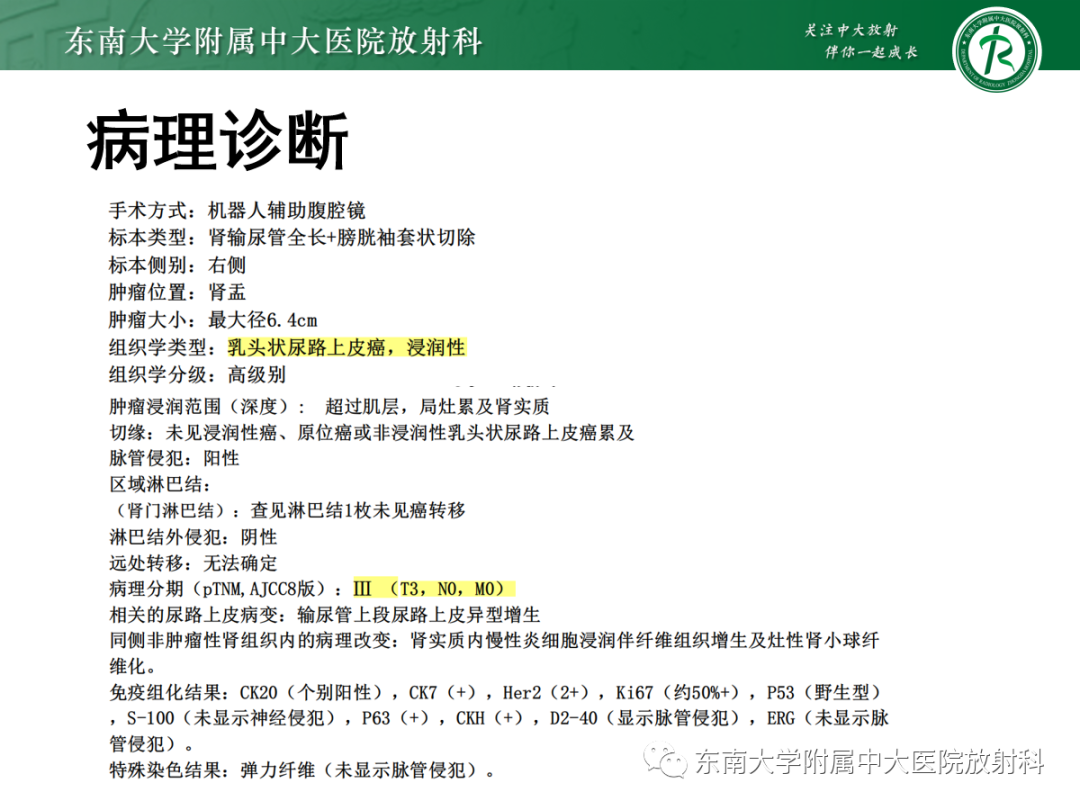 【PPT】肾盂癌-16