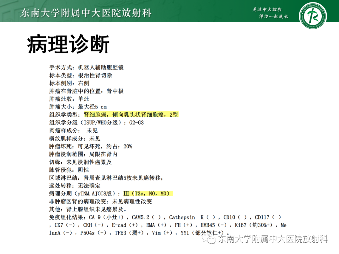 【PPT】肾盂癌-34