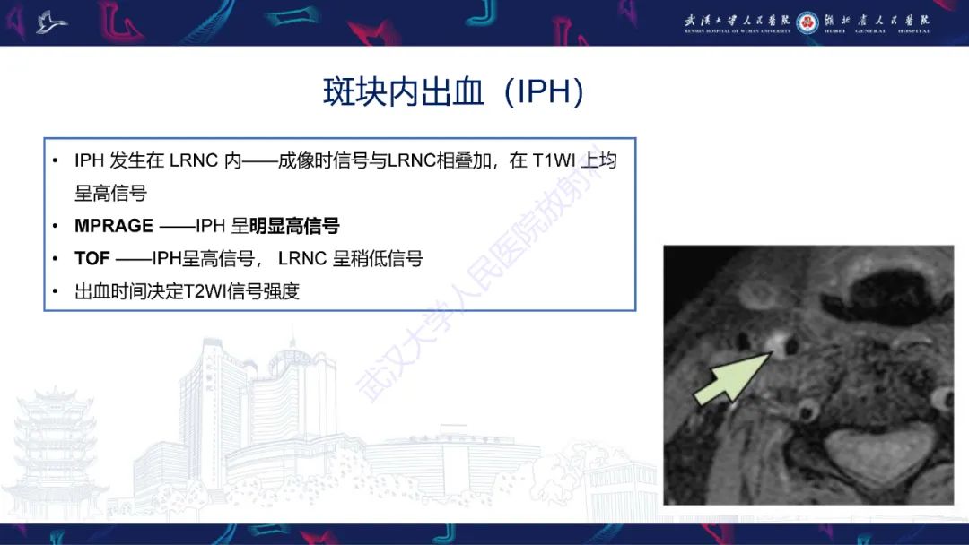 【PPT】颈动脉斑块HR-MR影像判读-19