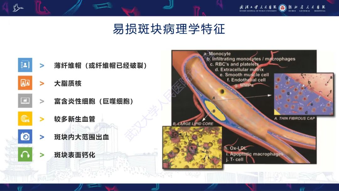 【PPT】颈动脉斑块HR-MR影像判读-5