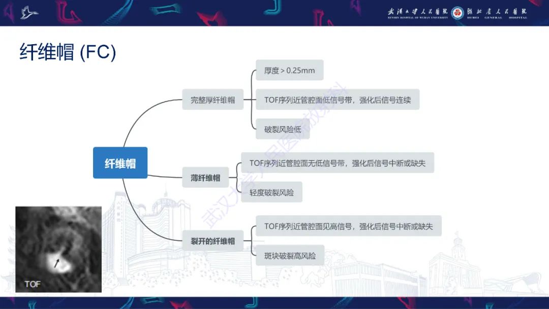 【PPT】颈动脉斑块HR-MR影像判读-15