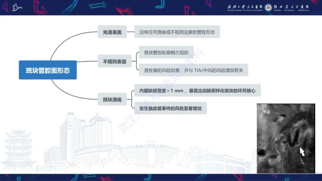 【PPT】颈动脉斑块HR-MR影像判读-11