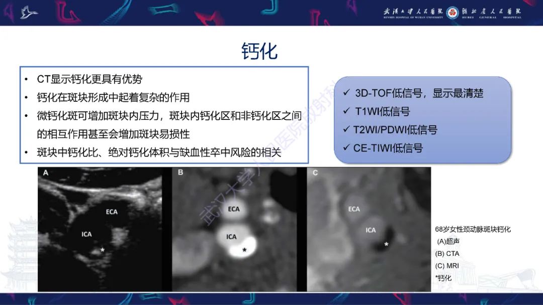 【PPT】颈动脉斑块HR-MR影像判读-23