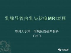 <b>乳腺导管内乳头状瘤MRI表现</b>