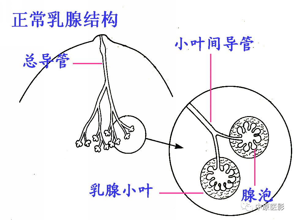 【PPT】乳腺导管内乳头状瘤MRI表现-5