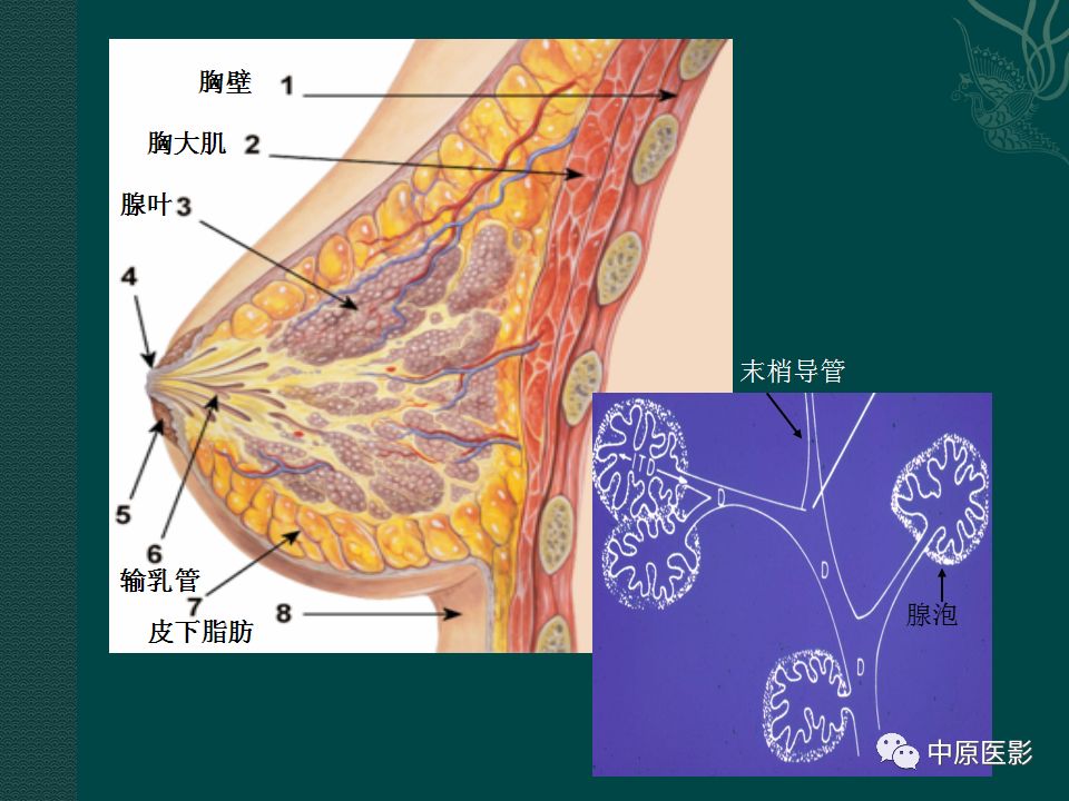 【PPT】乳腺导管内乳头状瘤MRI表现-3
