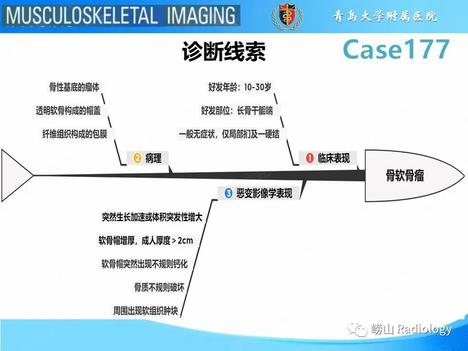 【PPT】骨软骨瘤-恶变-21