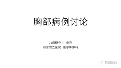 前纵隔畸胎瘤2例CT影像