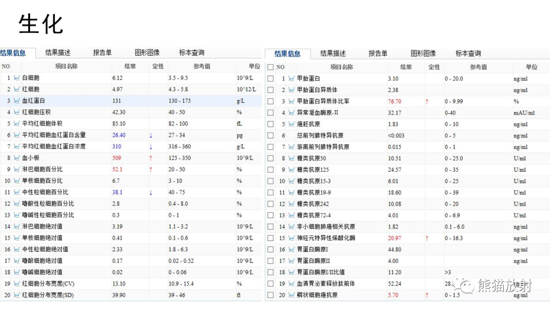 【病例】前纵隔畸胎瘤2例CT影像-9