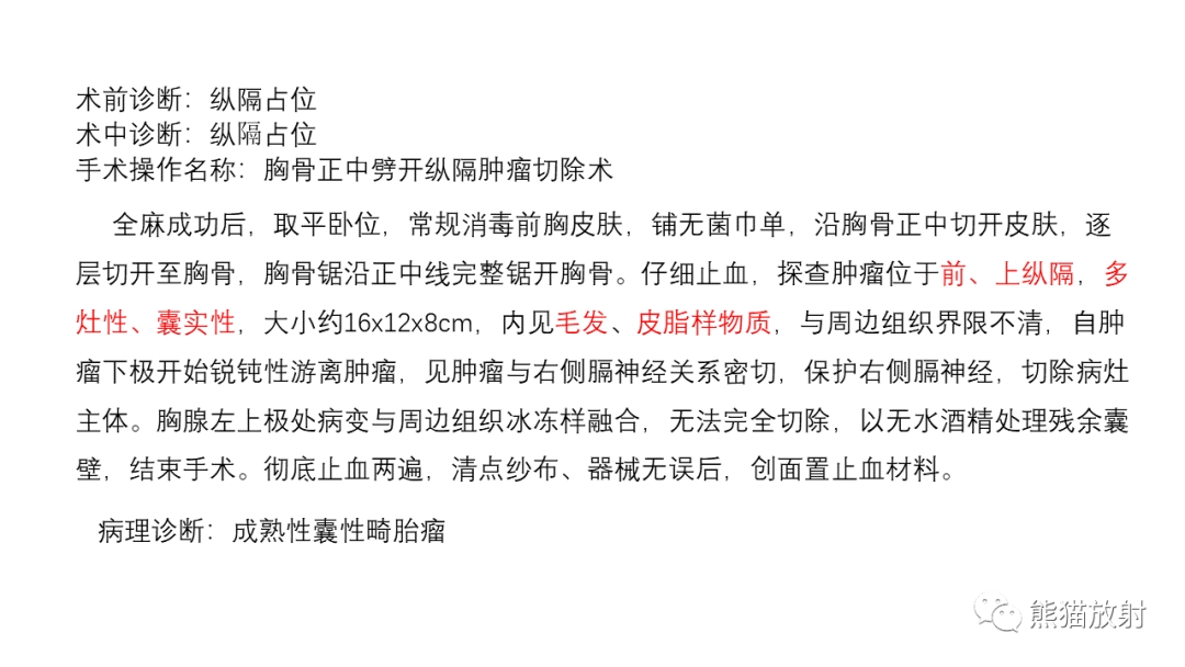 【病例】前纵隔畸胎瘤2例CT影像-17