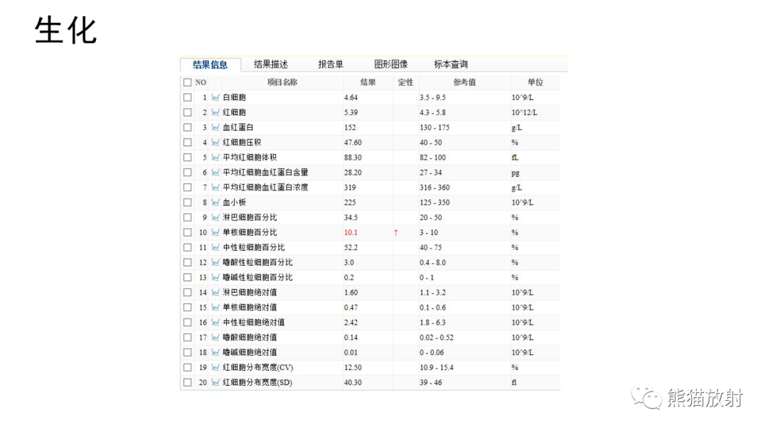 【病例】前纵隔畸胎瘤2例CT影像-3