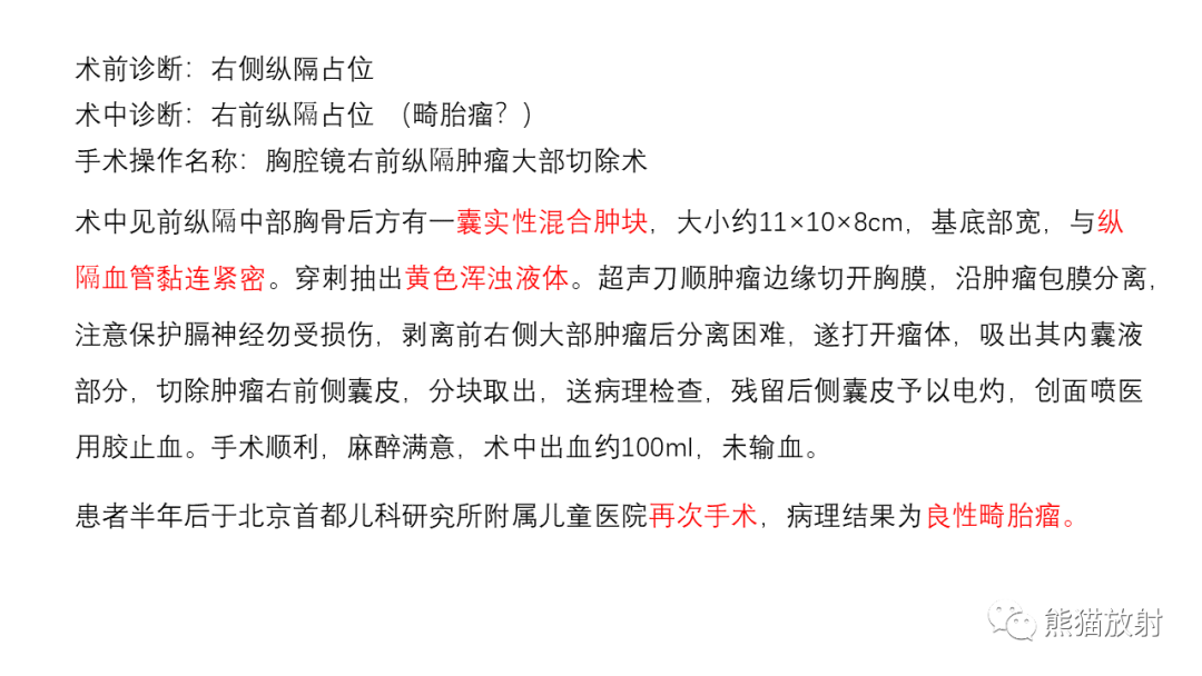 【病例】前纵隔畸胎瘤2例CT影像-19