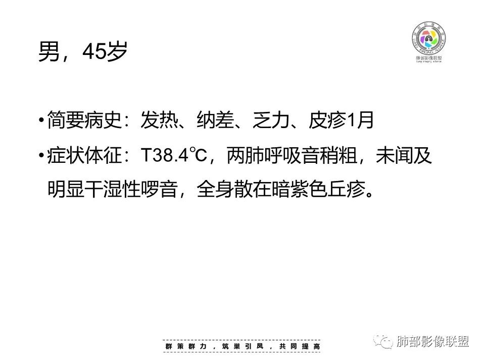 【病例】HIV卡波西肉瘤1例肺部影像表现-2