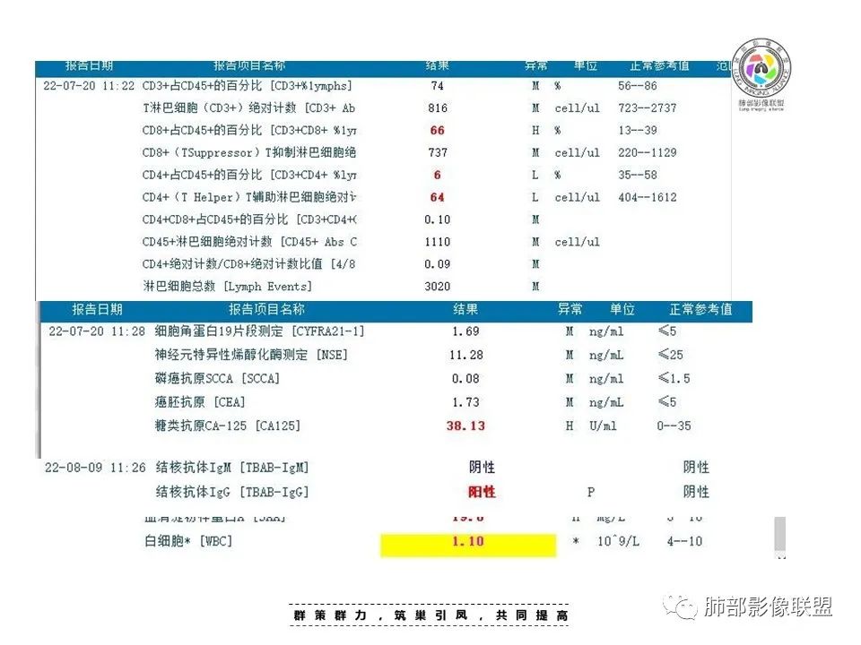 【病例】HIV卡波西肉瘤1例肺部影像表现-3