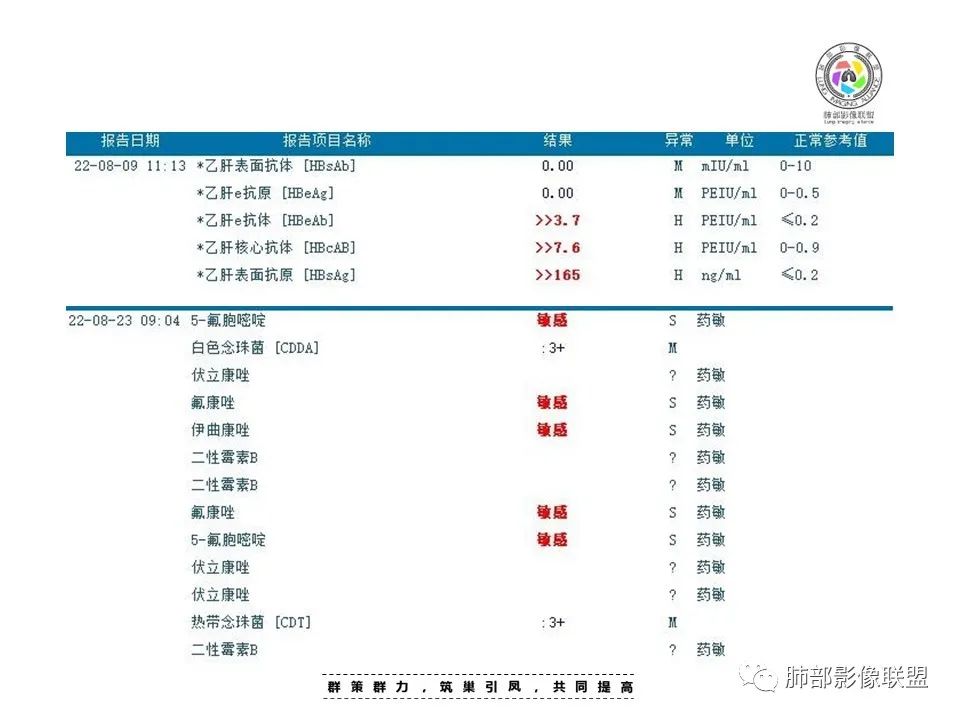 【病例】HIV卡波西肉瘤1例肺部影像表现-4