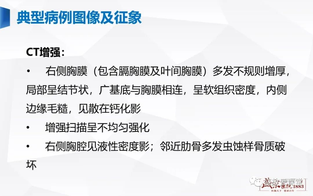 【PPT】胸膜病变-9