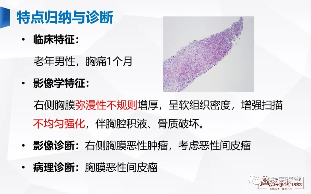 【PPT】胸膜病变-11