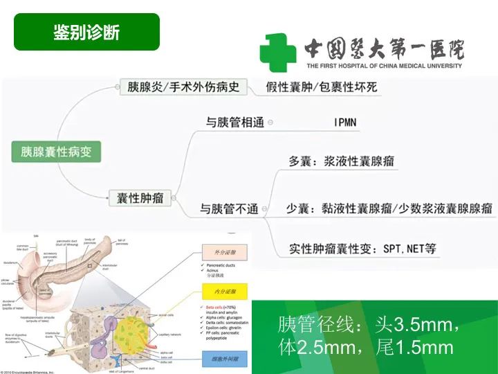 【病例】胰腺实性假乳头状瘤1例CT及MR影像-18