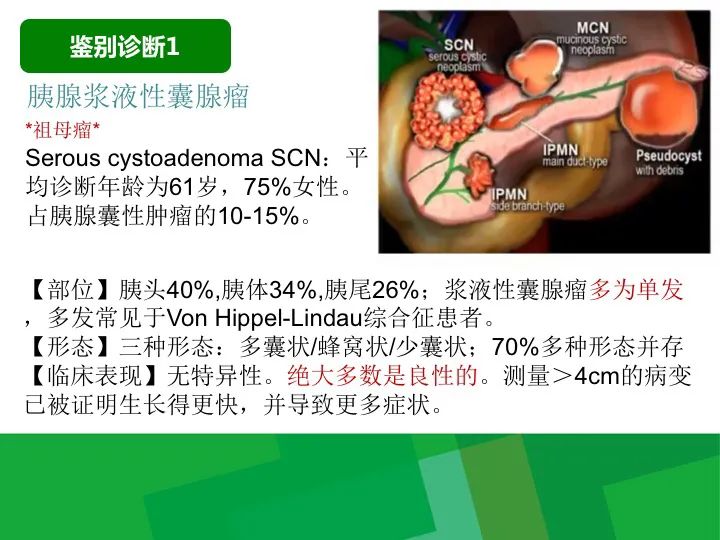 【病例】胰腺实性假乳头状瘤1例CT及MR影像-21
