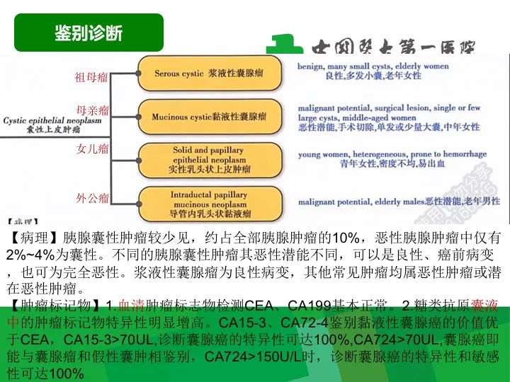 【病例】胰腺实性假乳头状瘤1例CT及MR影像-19