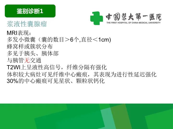 【病例】胰腺实性假乳头状瘤1例CT及MR影像-23